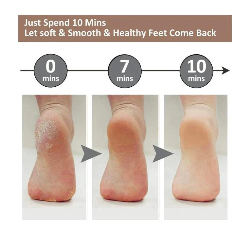 USB Foot Grinding Machine - Foot Care